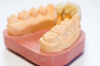 Diş hekimi laboratuvar ofis - diş alçı model yakın çekim. Alçı protez porselen dişleri beyaz arka plan üzerinde - kopya alanı izole