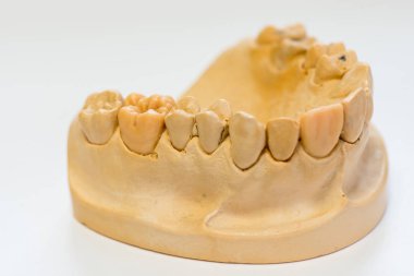 Diş hekimi laboratuvar ofis - diş alçı model yakın çekim. Alçı protez porselen dişleri beyaz arka plan üzerinde - kopya alanı izole