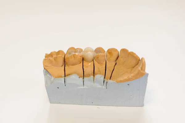 研究室歯医者 歯科用石膏モデル クローズ アップ 陶歯ホワイト バック グラウンド コピー領域に分離された石膏総義歯 — ストック写真