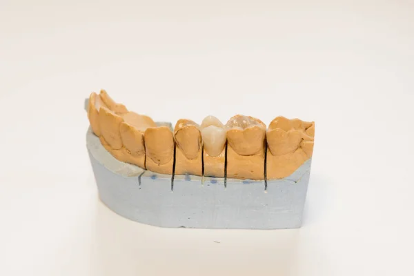 研究室歯医者 歯科用石膏モデル クローズ アップ 陶歯ホワイト バック グラウンド コピー領域に分離された石膏総義歯 — ストック写真