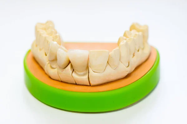 Modelo Yeso Dental Consultorio Del Laboratorio Del Dentista Primer Plano —  Fotos de Stock