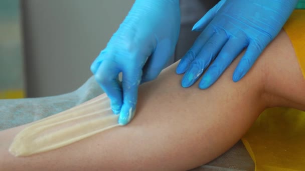 Close-up of the hand in rubber gloves is applied to the hair removal paste and by special technology shugaring removes hair — Stock Video