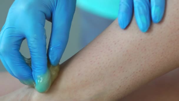 Gros plan dans le salon de beauté maître en gants faisant la procédure pour enlever les cheveux sur les jambes avec un mélange de sucre — Video