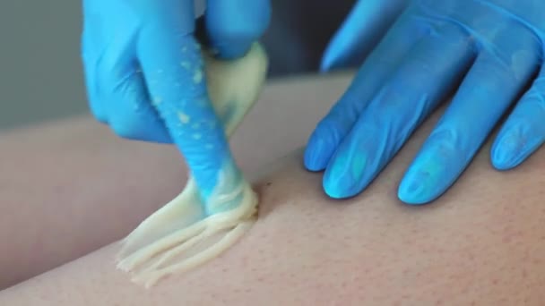 Крупный план руки мастера по удалению волос удалить мелкие волоски с помощью специальной техники сахарирования делает острые рывки рукой — стоковое видео