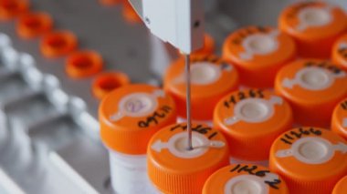 Yakın çekim tıbbi laboratuvar kanser hücre algılama kanser hastalarında işlem otomatik