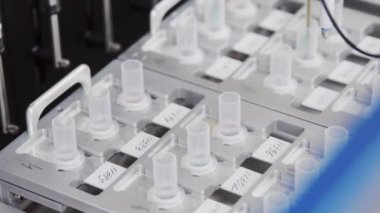 Otomatik laboratuvarda Teknik olarak gelişmiş klinik diyabet, pankreas hücreleri ve kan derin bir analizi ile mücadele amaçlayan bir çalışma yürütüyor