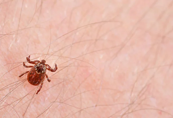 Danger of tick bite. Mite on the skin