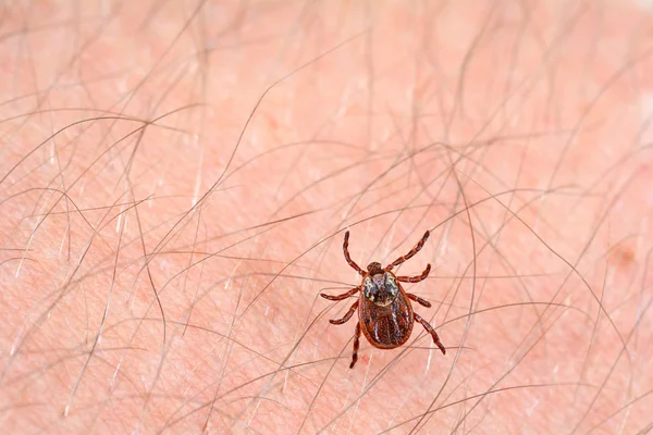 Danger Tick Bite Mite Skin Stock Photo