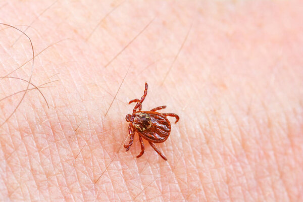 Mite on the skin. Danger of tick bite. 