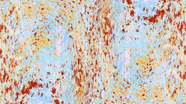 eski püskü boya ve sıva çatlakları