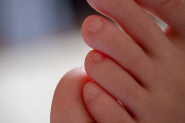 Erkek ayak parmakları, sağlıklı ayak tırnakları