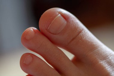 Erkek ayak parmakları, sağlıklı ayak tırnakları