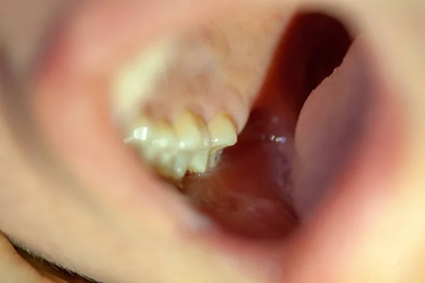 El concepto de tratamiento dental en una clínica dental — Foto de Stock