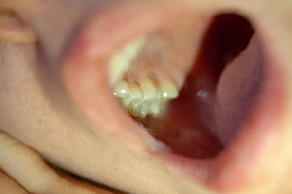 El concepto de tratamiento dental en una clínica dental — Foto de Stock