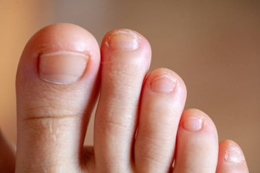 Erkek ayak parmakları, sağlıklı ayak tırnakları