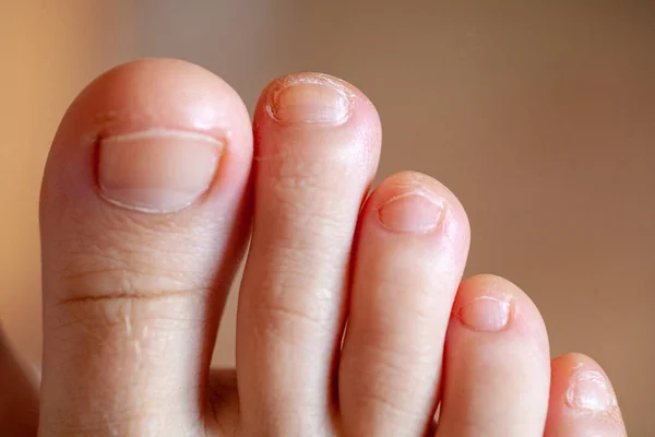 Men's toes, healthy toe nails — Stock Photo, Image