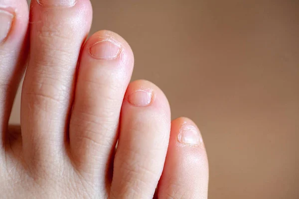 Men's toes, healthy toe nails — Stock Photo, Image