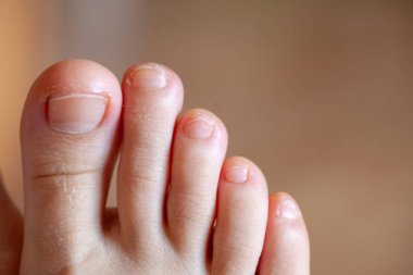 Erkek ayak parmakları, sağlıklı ayak tırnakları
