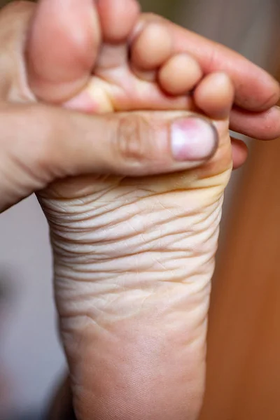 Men's toes, healthy toe nails