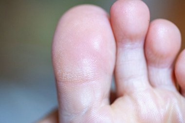 Erkek ayak parmakları, sağlıklı ayak tırnakları