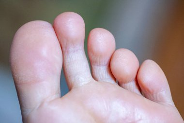 Erkek ayak parmakları, sağlıklı ayak tırnakları