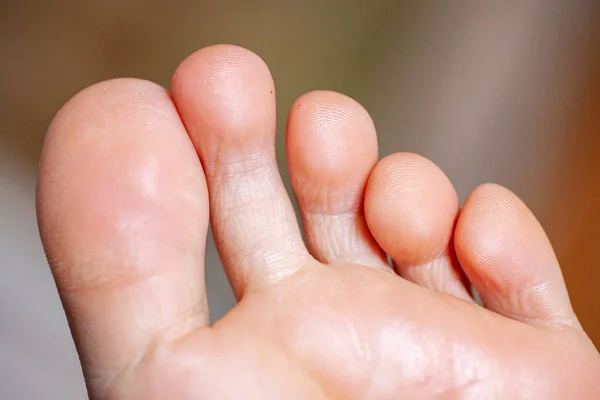 Dedos dos homens, unhas saudáveis dos pés — Fotografia de Stock