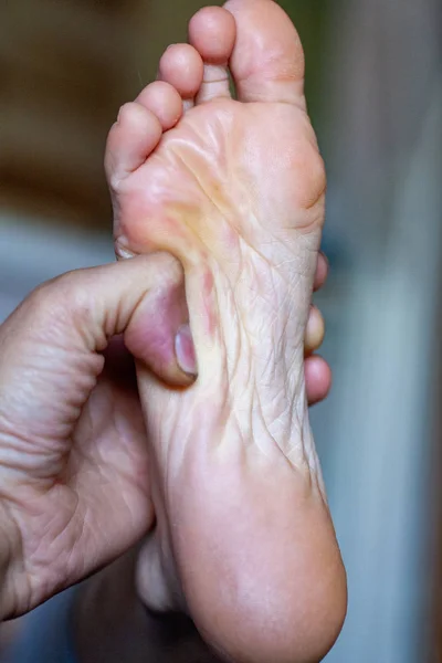 Orteils d'hommes, ongles d'orteils sains — Photo