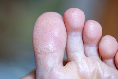 Genç kızın parmakları sağlıklı ve güzel. Tıbbi malzemeler ve merhemler için iyi hazırlanmış bir kavram, ayakların görüntüsü. İfadeler ve reklamlar için alanı olan bacakların resmi.