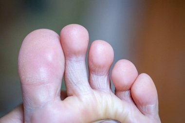 Genç kızın parmakları sağlıklı ve güzel. Tıbbi malzemeler ve merhemler için iyi hazırlanmış bir kavram, ayakların görüntüsü. İfadeler ve reklamlar için alanı olan bacakların resmi.