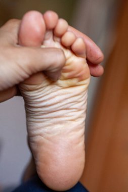 Genç kızın parmakları sağlıklı ve güzel. Tıbbi malzemeler ve merhemler için iyi hazırlanmış bir kavram, ayakların görüntüsü. İfadeler ve reklamlar için alanı olan bacakların resmi.