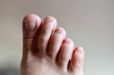 Genç kızın parmakları sağlıklı ve güzel. Tıbbi malzemeler ve merhemler için iyi hazırlanmış bir kavram, ayakların görüntüsü. İfadeler ve reklamlar için alanı olan bacakların resmi.