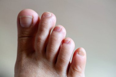 Genç kızın parmakları sağlıklı ve güzel. Tıbbi malzemeler ve merhemler için iyi hazırlanmış bir kavram, ayakların görüntüsü. İfadeler ve reklamlar için alanı olan bacakların resmi.