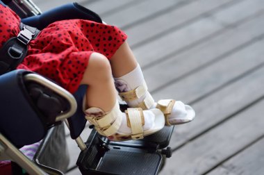 Tekerlekli sandalyede oturan engelli kız. Bacaklarında ortez. Çocuk serebral palsi. Eklenmesi.
