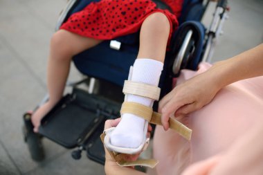 Anne kızının bacaklarını orteze sokar. Tekerlekli sandalyede oturan engelli kız. Çocuk serebral palsi.