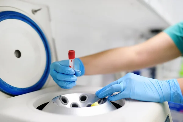 La donna del laboratorio mette in un tubo di centrifuga di sangue. Esami generali del sangue, esami biochimici e oligoelementi . — Foto Stock