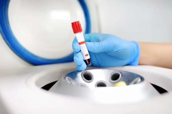 La donna del laboratorio mette in un tubo di centrifuga di sangue. Esami generali del sangue, esami biochimici e oligoelementi . — Foto Stock