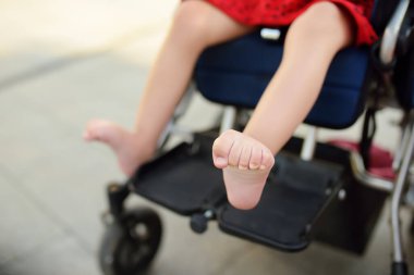 Tekerlekli sandalyede oturan engelli kız. Bacağındaki spazm kaslarının fotoğrafını çek. Çocuk serebral felci. Engelli. Katılım. Engelli çocuklu bir aile. Engelli çocuklu aile.