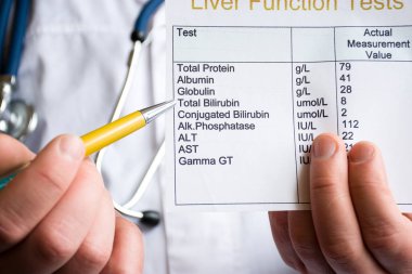 Analysis of bilirubin concept photo. Doctor holding laboratory test of liver function and indicates ballpoint pen on rate of total bilirubin. Raising or lowering level as indicator of liver disease clipart