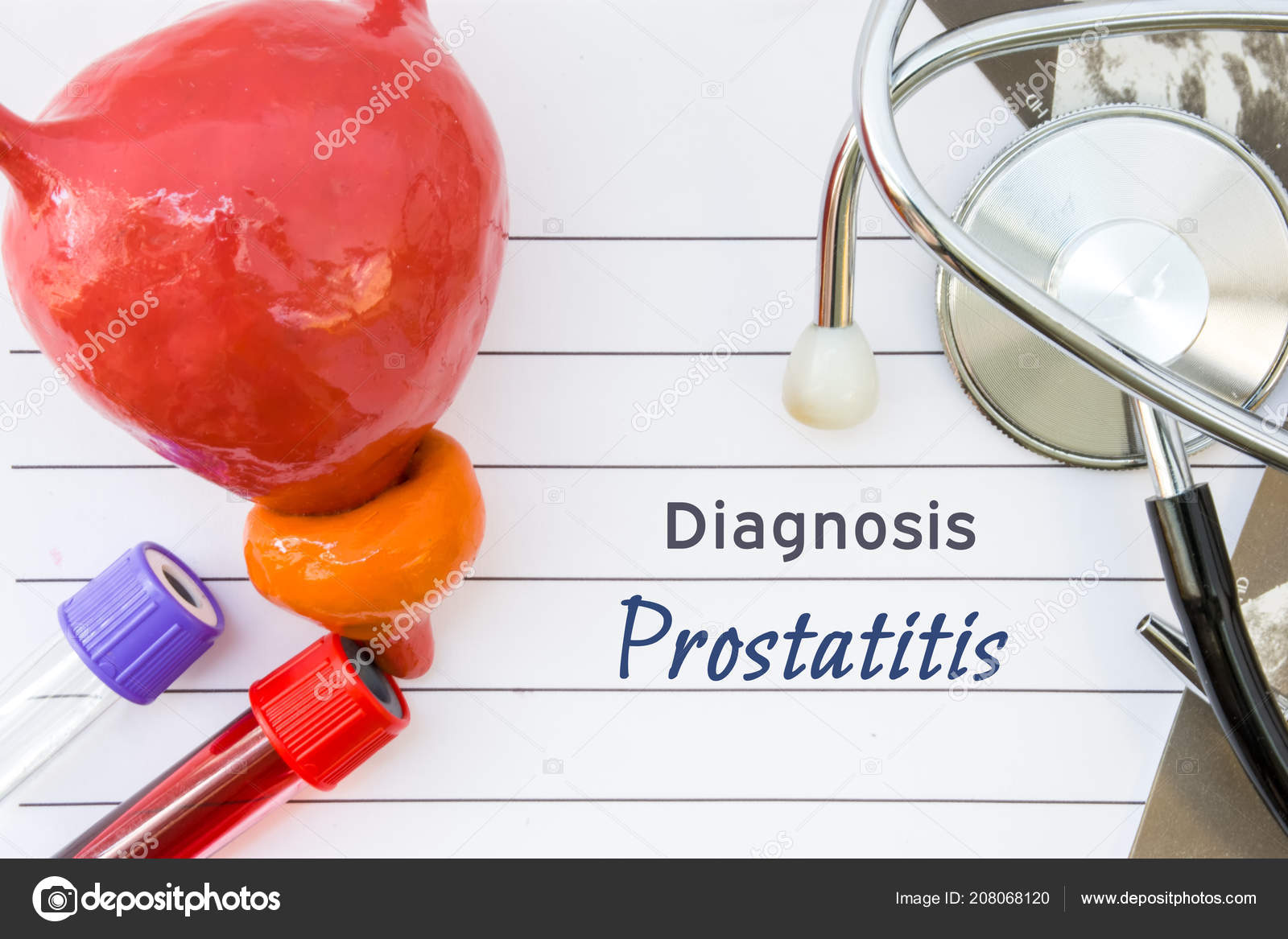 A prostatitis következményeinek kezelése