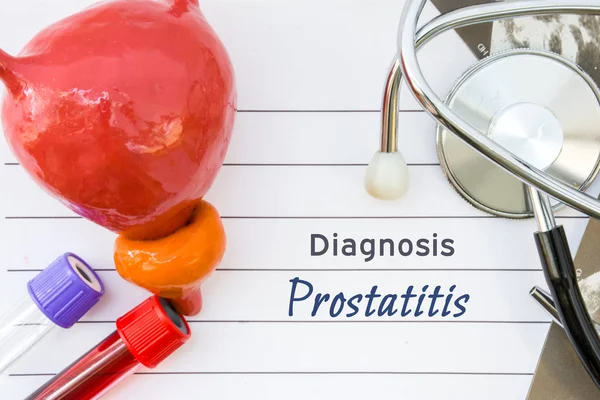 Diagnos Prostatit Medicinska Begrepp Bilden Prostata Sjukdom Prostatit Med Anatomisk — Stockfoto