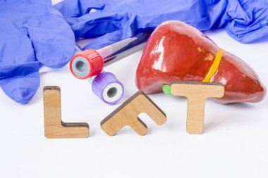 LFT klinik laboratuvar tıbbi kısaltma veya karaciğer sağlığını belirlemek karaciğer fonksiyon testlerinin, kısaltma. Word Lft vardır Hépar, laboratuvar test tüpleri ile kan örneği, rakam yakınındaki stetoskop