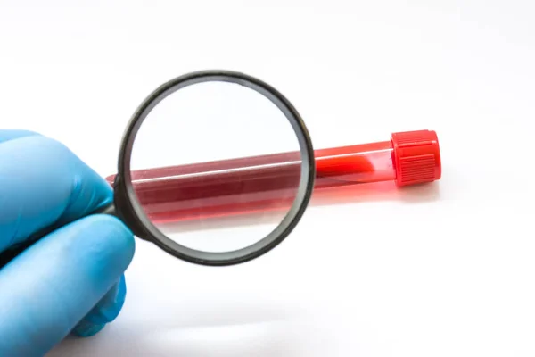 Diagnóstico Sangue Para Presença Doenças Médico Técnico Laboratório Médico Mão — Fotografia de Stock