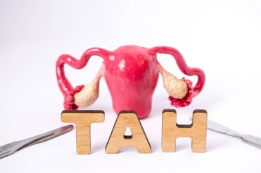 Rahim yumurtalık ile anatomik şekli arka plan biraz bulanık olduğunu ve ön planda harfler hangi formu tıbbi kısaltma Tah (Toplam Abdominal histerektomi) word odaklı bir