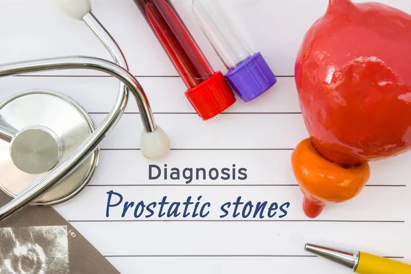 Diagnosis Prostatic Stones Figure Prostate Located Next Title Prostatic Stones — Stock Photo, Image
