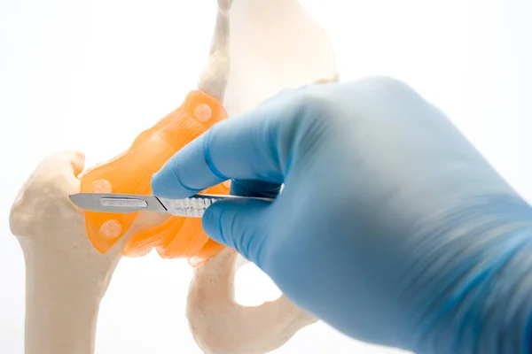 整形外科のコンセプト写真 医師は手袋をはめた手メス人間の股関節の解剖学的モデルの近くで保持します 骨破壊の融合などの整形外科手術のための写真のアイデア — ストック写真