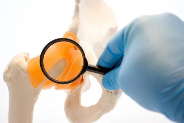 人間の股関節の病気の診断の概念写真 股関節の解剖学的モデルの医師を保持している虫眼鏡 検査し 疾患との必要性の存在下で骨盤の骨関節義肢 — ストック写真