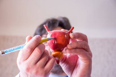 Doctor on defocused background holds in his hand anatomic model of bladder with prostate, pointing with pen in hand on urinary bladder in foreground. Localizing pathology, illness or problems  clipart