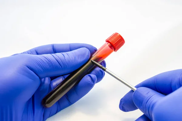 Médico Científico Sostiene Tubo Laboratorio Mano Enguantado Con Sangre Señala —  Fotos de Stock