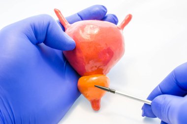 Doktor, bilim adamı, öğretmen ya da anatomi uzmanı prostat bezi modeli mesane ve prostat idrar yolu - organların bir işaretçi belirtir. Anormallikler prostatit gibi geçtiği yer
