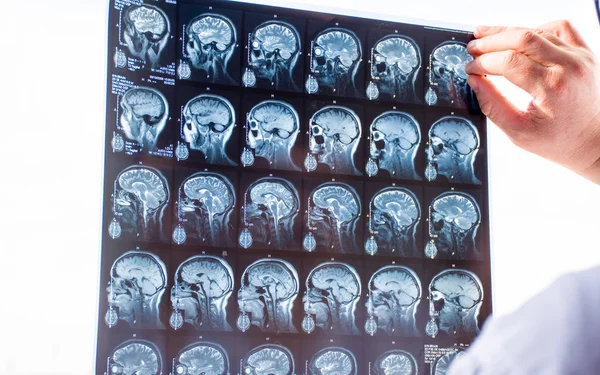 Beyin MR'ı ile incelenmesi. Hastaların acil sipariş taramaları taze anlık görüntü Doktor Röntgen görüntüleme kutusunu kullanarak ve hematom, tümör, travma veya travmatik ihlal için el ile tutarak MRI beyin 